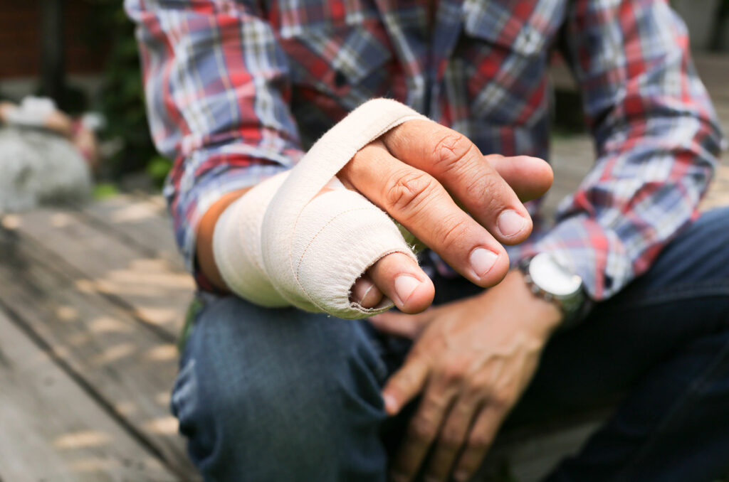 hand finger injury compensation claims solicitors Glasgow
