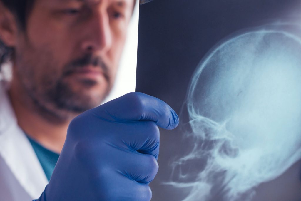 examining x-ray of skull - brain/head injury claim compensation
